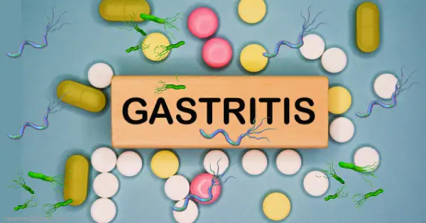 Cause of Gastritis, Excess of pills and Helicobacter pylori